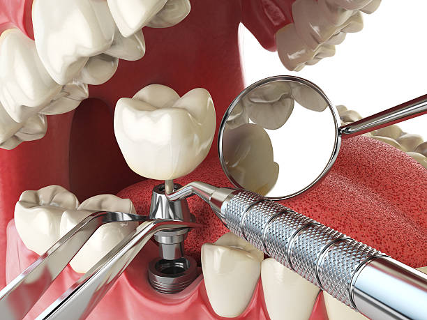 Best Emergency Orthodontic Repairs in Newberry, MI